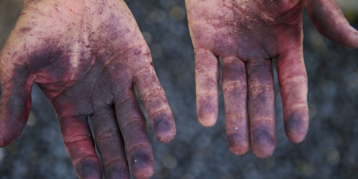 purple hands from handling açai