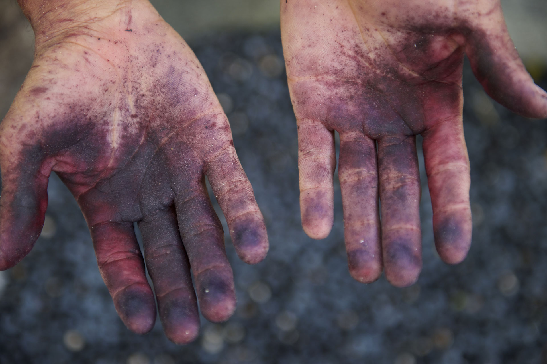 purple hands from handling açai